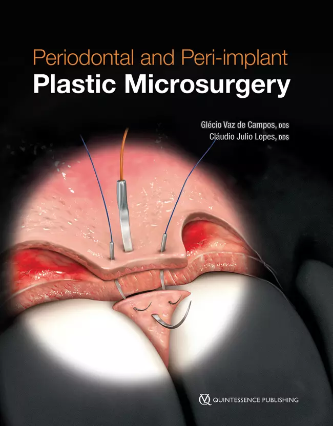 Periodontal and Peri-implant Plastic Microsurgery - Orginal Pdf